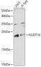 Nudix Hydrolase 16 antibody, 18-122, ProSci, Western Blot image 