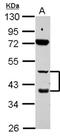 Retinoic Acid Receptor Beta antibody, NBP2-20129, Novus Biologicals, Western Blot image 