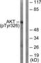 Akt antibody, TA313263, Origene, Western Blot image 