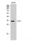 Forkhead box protein E1 antibody, LS-C383532, Lifespan Biosciences, Western Blot image 