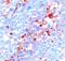 Activin A Receptor Type 1 antibody, AF637, R&D Systems, Immunohistochemistry paraffin image 