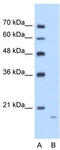 Amyloid P Component, Serum antibody, TA346302, Origene, Western Blot image 