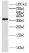 Metallophosphoesterase Domain Containing 1 antibody, FNab05294, FineTest, Western Blot image 