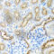 40S ribosomal protein S2 antibody, A6728, ABclonal Technology, Immunohistochemistry paraffin image 