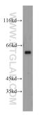 Protein Phosphatase 3 Catalytic Subunit Gamma antibody, 19653-1-AP, Proteintech Group, Western Blot image 