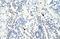Pogo Transposable Element Derived With ZNF Domain antibody, ARP39172_T100, Aviva Systems Biology, Immunohistochemistry paraffin image 