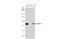 P2Y2R antibody, GTX114609, GeneTex, Western Blot image 