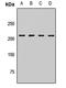 Myosin VA antibody, LS-C668206, Lifespan Biosciences, Western Blot image 