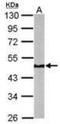 NADH dehydrogenase [ubiquinone] iron-sulfur protein 2, mitochondrial antibody, orb181689, Biorbyt, Western Blot image 