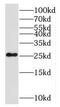 Noggin antibody, FNab05782, FineTest, Western Blot image 