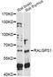 Ral GEF With PH Domain And SH3 Binding Motif 1 antibody, LS-C749808, Lifespan Biosciences, Western Blot image 