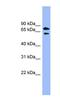 Pantothenate Kinase 4 antibody, NBP1-55013, Novus Biologicals, Western Blot image 