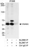 PBEF antibody, A300-778A, Bethyl Labs, Immunoprecipitation image 