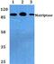 Suppression Of Tumorigenicity 14 antibody, A02614, Boster Biological Technology, Western Blot image 