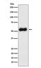 Thromboxane A Synthase 1 antibody, M04697-1, Boster Biological Technology, Western Blot image 