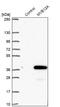 Multivesicular Body Subunit 12A antibody, NBP1-91883, Novus Biologicals, Western Blot image 
