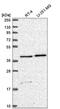 Solute Carrier Family 18 Member B1 antibody, NBP2-56822, Novus Biologicals, Western Blot image 