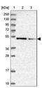 Zinc Finger Protein 181 antibody, NBP1-92618, Novus Biologicals, Western Blot image 