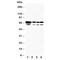 Heat Shock Protein Family A (Hsp70) Member 2 antibody, R30912, NSJ Bioreagents, Western Blot image 