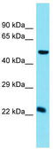 Charged Multivesicular Body Protein 5 antibody, TA337965, Origene, Western Blot image 