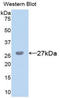 Chitinase 3 Like 1 antibody, LS-C302571, Lifespan Biosciences, Western Blot image 