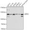Eukaryotic translation initiation factor 3 subunit C antibody, 22-638, ProSci, Western Blot image 