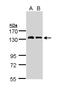GC-A antibody, LS-C109432, Lifespan Biosciences, Western Blot image 