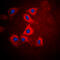 Hexosaminidase Subunit Beta antibody, GTX55224, GeneTex, Immunofluorescence image 