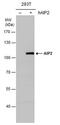 NEDD4-like E3 ubiquitin-protein ligase WWP2 antibody, PA5-78355, Invitrogen Antibodies, Western Blot image 