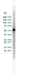 Keratin 5 antibody, MA5-16372, Invitrogen Antibodies, Western Blot image 