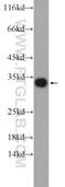 Mannose Binding Lectin 2 antibody, 24207-1-AP, Proteintech Group, Western Blot image 