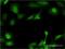 UDP-GlcNAc:betaGal beta-1,3-N-acetylglucosaminyltransferase 3 antibody, H00010331-M01, Novus Biologicals, Immunocytochemistry image 