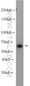 GRK1 antibody, 24606-1-AP, Proteintech Group, Western Blot image 