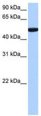 SDE2 Telomere Maintenance Homolog antibody, TA338885, Origene, Western Blot image 