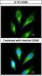 Lysosomal acid phosphatase antibody, GTX114234, GeneTex, Immunofluorescence image 