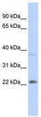 Sex-determining region Y protein antibody, TA338241, Origene, Western Blot image 