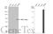 HNF1 Homeobox A antibody, GTX113850, GeneTex, Western Blot image 