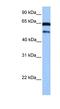 Zinc Finger And SCAN Domain Containing 5B antibody, NBP1-91411, Novus Biologicals, Western Blot image 