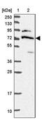 DEAD-Box Helicase 55 antibody, PA5-60612, Invitrogen Antibodies, Western Blot image 