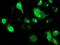 Signal Sequence Receptor Subunit 1 antibody, MA5-25635, Invitrogen Antibodies, Immunocytochemistry image 