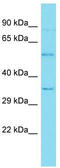 Oncoprotein-induced transcript 3 protein antibody, TA334800, Origene, Western Blot image 