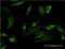 P2Y purinoceptor 1 antibody, H00005028-M01, Novus Biologicals, Immunofluorescence image 