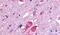 Galanin receptor type 2 antibody, PA5-33575, Invitrogen Antibodies, Immunohistochemistry paraffin image 