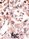 Dual specificity protein phosphatase 3 antibody, abx033968, Abbexa, Immunohistochemistry paraffin image 