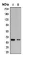 Vasodilator Stimulated Phosphoprotein antibody, orb393186, Biorbyt, Western Blot image 