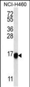 Uncharacterized protein CXorf1 antibody, PA5-48519, Invitrogen Antibodies, Western Blot image 