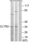 Cysteinyl Leukotriene Receptor 2 antibody, LS-C120640, Lifespan Biosciences, Western Blot image 