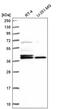 Core histone macro-H2A.1 antibody, PA5-65647, Invitrogen Antibodies, Western Blot image 