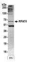 Replication Protein A1 antibody, A300-241A, Bethyl Labs, Western Blot image 