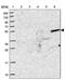 Zinc Finger Protein 627 antibody, PA5-62037, Invitrogen Antibodies, Western Blot image 
